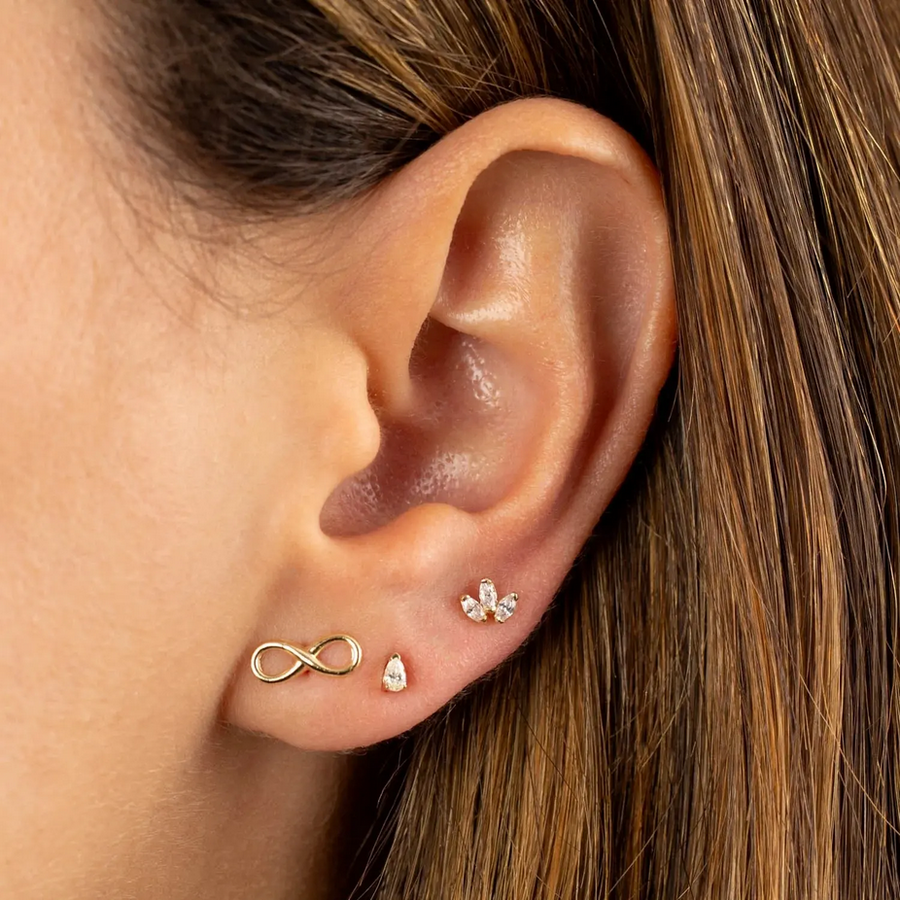 Arete Peonia